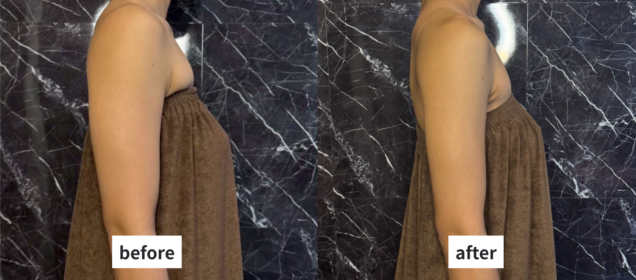 脚・二の腕痩せ 新規限定プラン